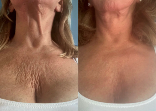 Silk Body Oil customer result